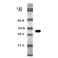 Western blot analysis of human plasma adiponectin using anti-Adiponectin (human), mAb (HADI 773) (Prod. No. AG-20A-0001) at 0.2µg/ml. Western blot analysis of human plasma adiponectin using anti-Adiponectin (human), mAb (HADI 773) (Prod. No. AG-20A-0001) at 0.2µg/ml.