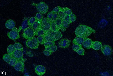 Immunofluorescent confoacal imaging of HEK293 cells using anti-Nampt (Visfatin-PBEF), mAb (OMNI379) (Prod. No. AG-20A-0034). Nampt(Visfatin/PBEF) (green staining) is localized in the cytoplasm and nucleus (400x magnification). Nuclei are stained with Hoechst (blue staining). Immunofluorescent confoacal imaging of HEK293 cells using anti-Nampt (Visfatin-PBEF), mAb (OMNI379) (Prod. No. AG-20A-0034). Nampt(Visfatin/PBEF) (green staining) is localized in the cytoplasm and nucleus (400x magnification). Nuclei are stained with Hoechst (blue staining).