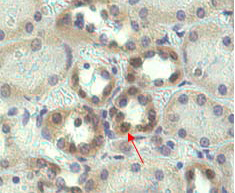 Immunohistochemical staining of Nampt using anti-Nampt (OMNI379) (Prod. No. AG-20A-0034B) in human kidney tissue (1:500 dilution). Immunoperoxidase staining of formalin-fixed and paraffin-embedded (FFPE) human kidney showing cytoplasmic staining (200x, brown color). Immunohistochemical staining of Nampt using anti-Nampt (OMNI379) (Prod. No. AG-20A-0034B) in human kidney tissue (1:500 dilution). Immunoperoxidase staining of formalin-fixed and paraffin-embedded (FFPE) human kidney showing cytoplasmic staining (200x, brown color).