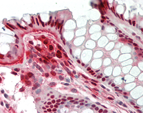 Immunohistochemical staining of Nampt using anti-Nampt (Visfatin/PBEF), mAb (OMNI379) (Prod. No. AG-20A-0034B) in formalin-fixed and paraffin-embedded (FFPE) human colon tissue (15µg/ml). Immunohistochemical staining of Nampt using anti-Nampt (Visfatin/PBEF), mAb (OMNI379) (Prod. No. AG-20A-0034B) in formalin-fixed and paraffin-embedded (FFPE) human colon tissue (15µg/ml).