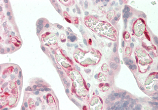 Immunohistochemical staining of IDO using anti-IDO (human), mAb (ID 177) (Prod. No. AG-20A-0035) in human placenta tissue (10µg/ml).<br /> This antibody has been tested in immunohistochemistry, analyzed by an anatomic pathologist and validated for use in IHC applications against formalin-fixed, paraffin-embedded human tissues. The image shows the localization of the antibody as the precipitated red signal, with a hematoxylin purple nuclear counterstain. Immunohistochemical staining of IDO using anti-IDO (human), mAb (ID 177) (Prod. No. AG-20A-0035) in human placenta tissue (10µg/ml).<br /> This antibody has been tested in immunohistochemistry, analyzed by an anatomic pathologist and validated for use in IHC applications against formalin-fixed, paraffin-embedded human tissues. The image shows the localization of the antibody as the precipitated red signal, with a hematoxylin purple nuclear counterstain.