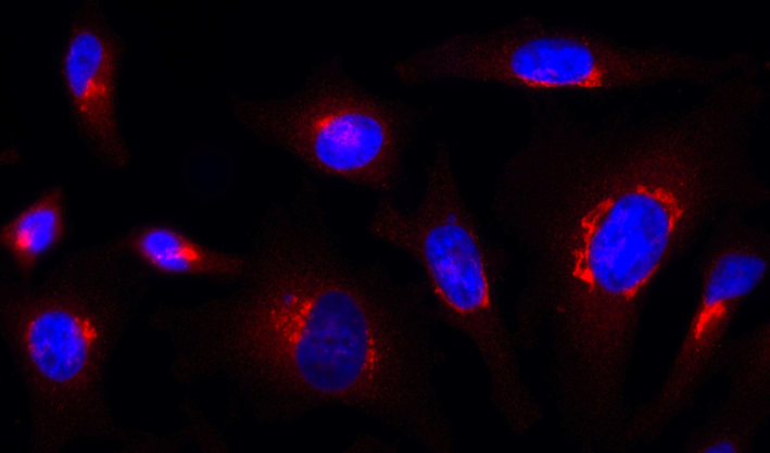 Rab1-GTP is detected by immunocytochemistry using anti-Rab1-GTP, mAb (ROF7) (Prod. No. &nbsp;AG-27B-0006). <br /><strong>Method:</strong> HeLa cells are grown in standard culture conditions, fixed with paraformaldehyde (3%), permeablized in  PBS+ BSA 0.2 % + Saponin 0.05 % and incubated with anti-Rab1-GTP, mAb (ROF7)(1&micro;g /ml ) in PBS-BSA-Saponin).  After incubation for 30 min at RT and several washes in PBS, cells are treated with a goat anti-human (Cy3) antibody in PBS-BSA-Saponin  for 30 min at RT, washed and mounted in Moewiol. Nuclei are stained with DAPI.  <br /><em>Picture courtesy of Dr. Moutel, Dr. Franck Perez lab, Curie Institute, Paris.</em>