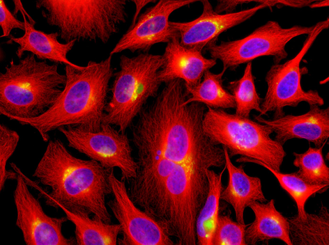Human &beta;-Tubulin is detected by immunocytochemistry using anti-&beta;-Tubulin, mAb (rec.) (S11B) (Prod. No. AG-27B-0008). <br /><strong>Method:</strong> HeLa cells are grown in standard culture conditions, fixed with methanol, and incubated with anti-beta-Tubulin, mAb (rec.)(S11B)(1&micro;g /ml in PBS-BSA). After incubation for 30 min at RT and several washes in PBS, cells are treated with  a goat anti-human (Cy3) antibody for 30 min at RT, washed and mounted in Moewiol. Nuclei are stained with DAPI.  <br /> <em>Picture courtesy of Dr. Moutel, Dr. Franck Perez lab, Curie Institute, Paris.</em>