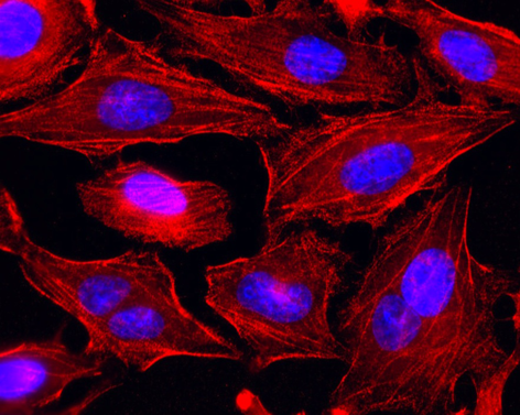 Human Myosin IIA (non-muscle) (heavy chain) is detected by immunocytochemistry using anti-myosin IIA (non-muscle) (rec.) (SF9) (Prod. No. AG-27B-0010). <br /><b>Method:</b> HeLa cells are grown in standard culture conditions, fixed with methanol, and incubated with anti-Myosin IIA  (non-muscle) (rec.) (SF9) (1&micro;g /ml in PBS-BSA). After incubation for 30 min at RT and several washes in PBS, cells are treated with  a goat anti-human (Cy3) antibody for 30 min at RT, washed and mounted in Moewiol. Nuclei are stained with DAPI.<br /> <em>Picture courtesy of Dr. Moutel, Dr. Franck Perez lab, Curie Institute, Paris.</em>