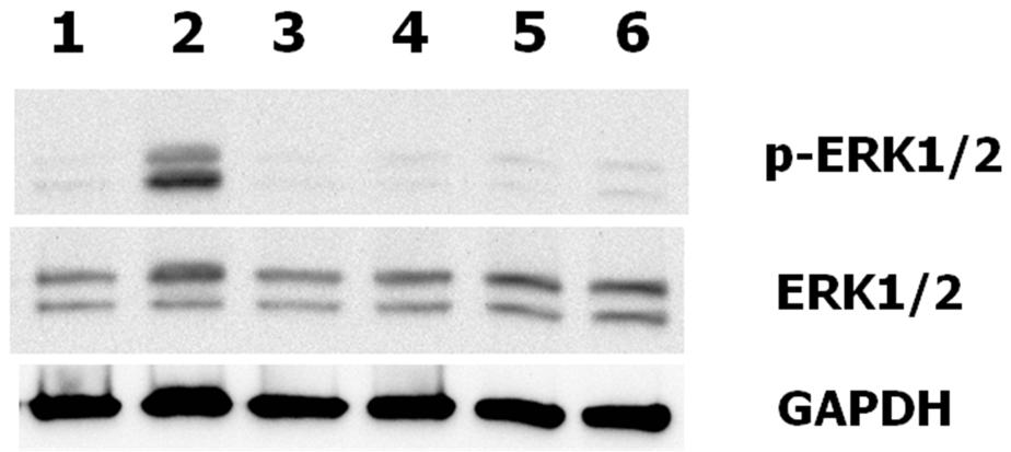 <b>The effects on phospho-ERK1/2 and non-phospho-ERK1/2 by Progranulin (human) (rec.) (untagged) (Prod. No. AG-40A-0188) in neuronal differentiated mouse P19 cells.</b> Undifferentiated mouse P19 embryonal carcinoma cells were induced to differentiated in 1&mu;M retinoic acid (RA) in &alpha;-minimum essential medium (&alpha;MEM) containing 10% heat-treated fetal bovine serum on bacterial grade plates for 3~4 days to allow aggregates to form (generation of embryonic bodies). The aggregates were then plated out tissue culture grade plates in the absence of RA for 3~4days. To examine the induction of signal of phospho-p44/42 MAPK and p44/42 MAP kinase, reactions were carried out at 37°C over 0, 5, 10, 30, 60, 120mins, respectively by adding the recombinant protein (500ng/ml) to the neuronal differentiated mouse P19 embryonal carcinoma cells, which were maintained with serum starvation for 24hrs.  Treatment with Progranulin (human) (rec.) (untagged) was performed in lanes 1, 2, 3, 4, 5, and 6 over 0, 5, 10, 30, 60, 120mins, respectively. GAPDH was used as loading control for western blotting.