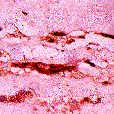 Immunohistochemical staining of MG adducts in atherosclerotic aorta using anti-MG, mAb (3C). Immunohistochemical staining of MG adducts in atherosclerotic aorta using anti-MG, mAb (3C).